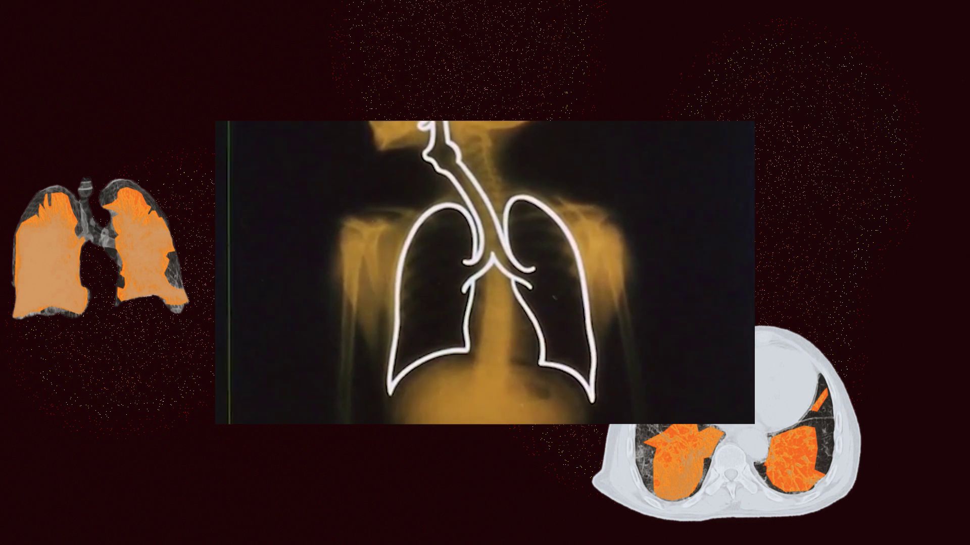 Membranes Image 3